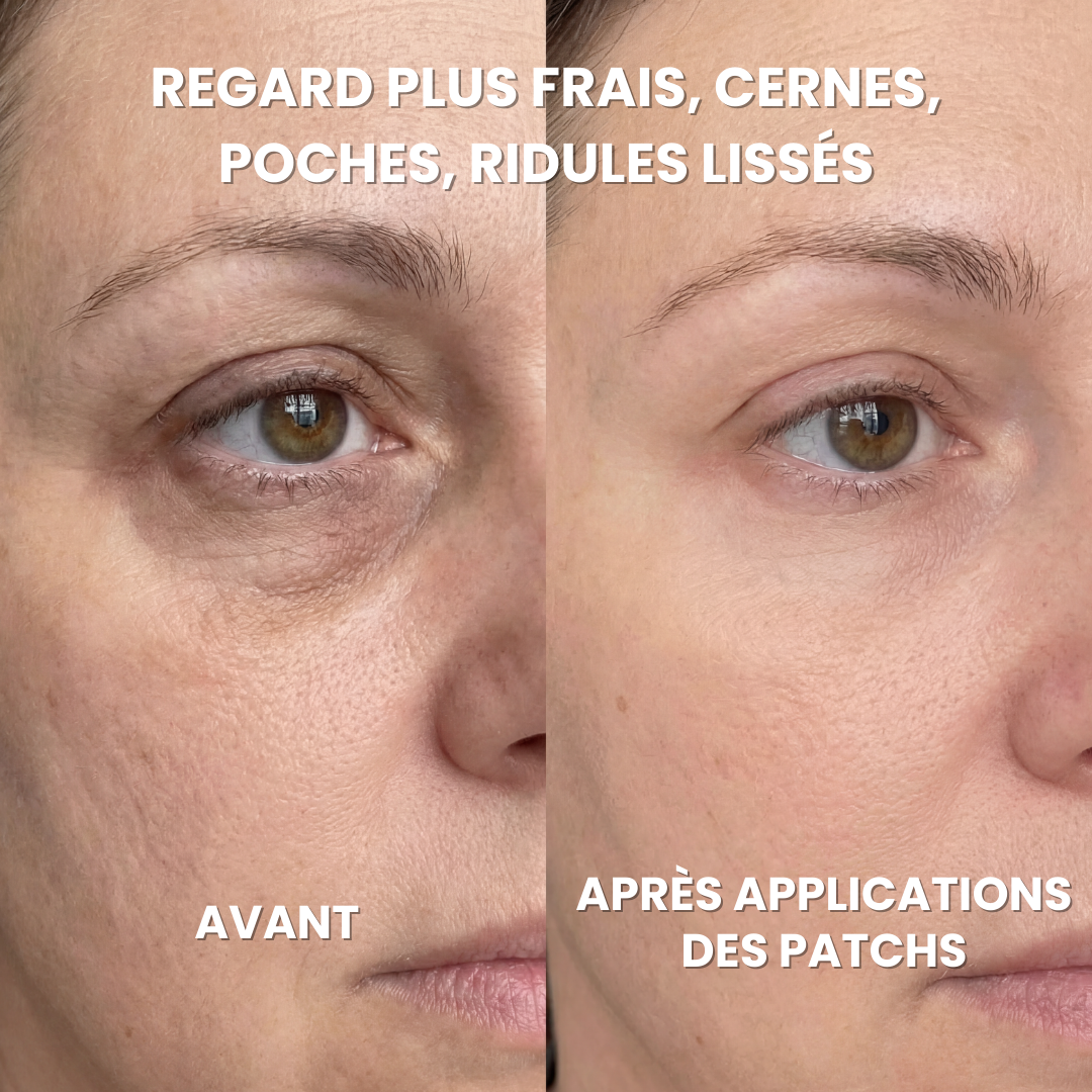 Patchs Hydrogel Anti-Cernes - Caféine, Collagène, Niacinamides