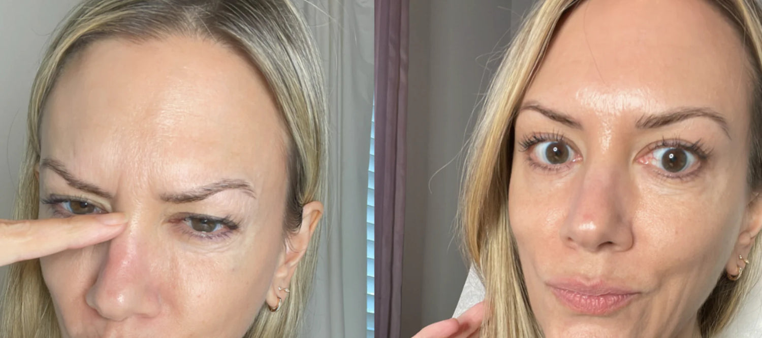 Taping facial avec des patchs en silicone de qualité médicale à 100%
