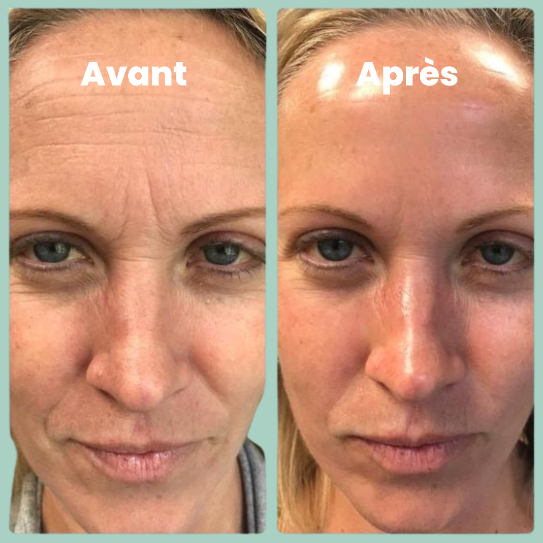 Bio-Collagen Mask