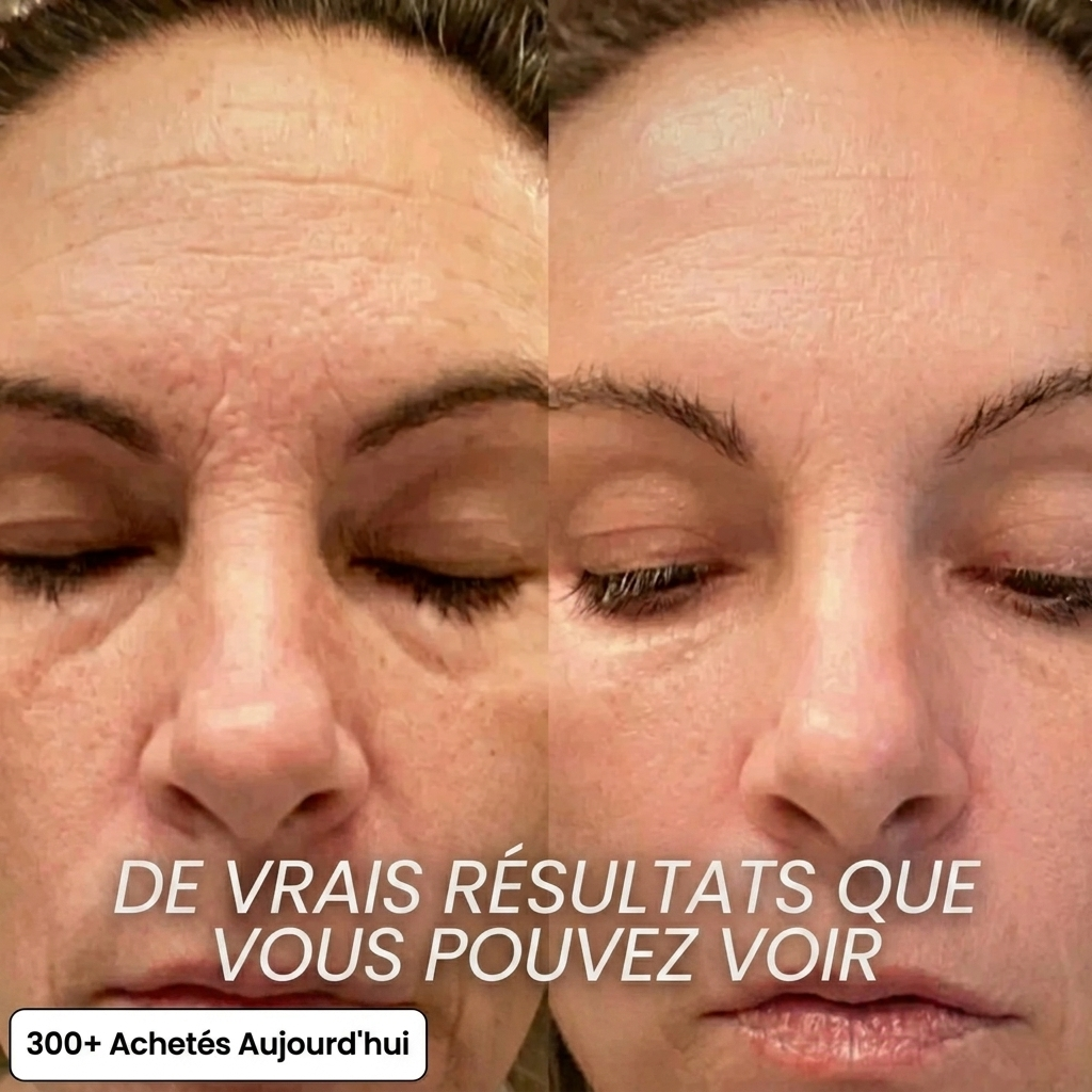 Lifting Stick Bio-Collagène